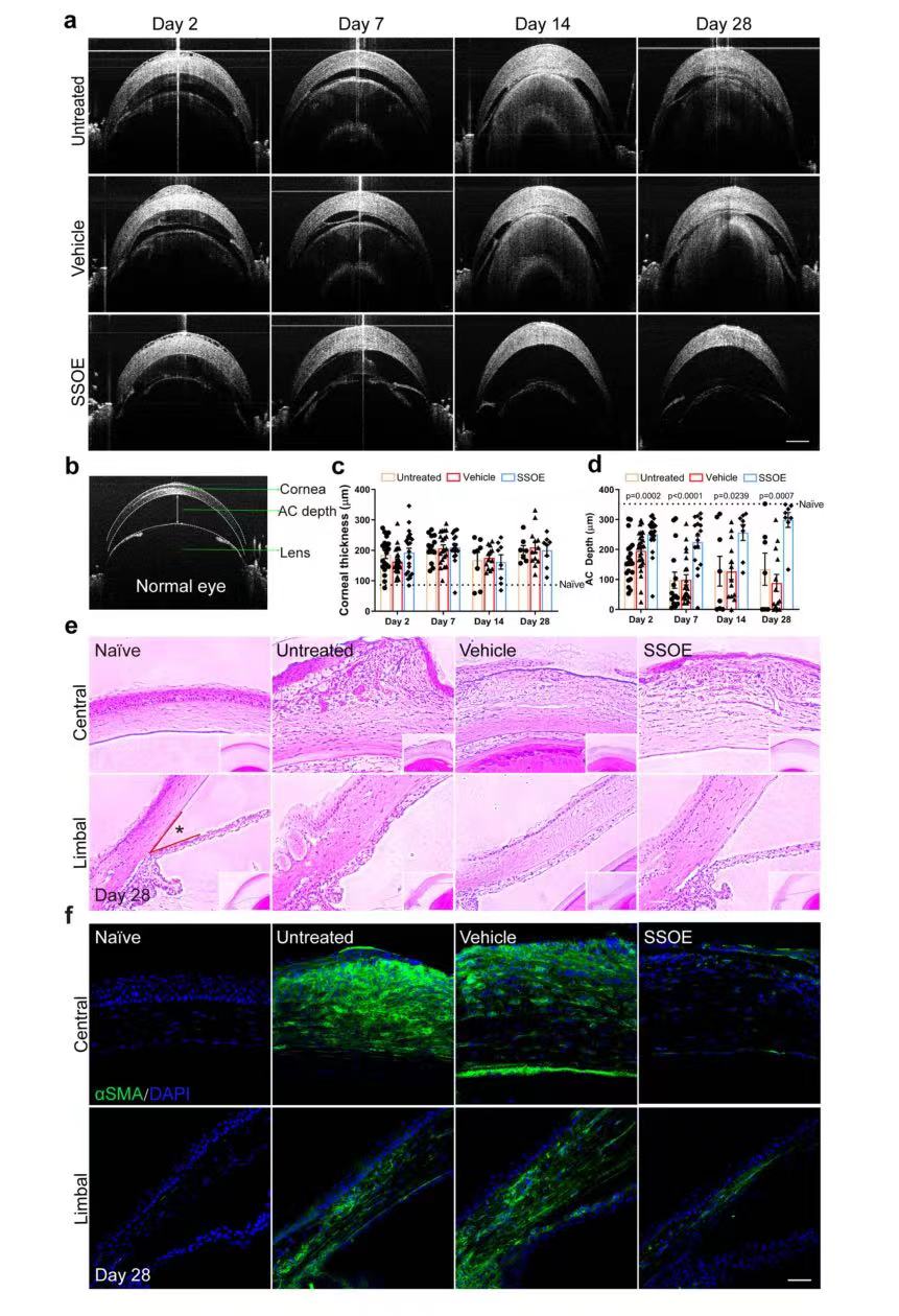 Perfluorodecalin-based oxygenated emulsion as a topical treatment for chemical burn to the eye